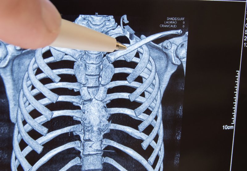 Anatomy… Why do we have clavicles?